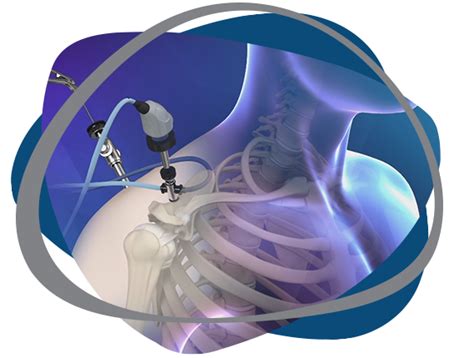 Artroscopia De Ombro Dr Felipe Cer Volo Lemos M Dico Ortopedista