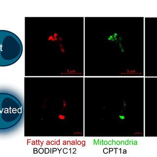 Colocalization Of BODIPY And The Mitochondria In T Cells Fatty Acid