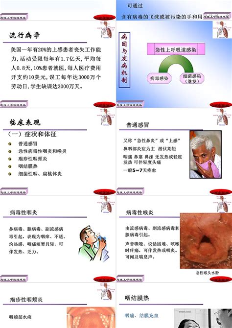 护理急性上呼吸道感染病人ppt模板卡卡办公