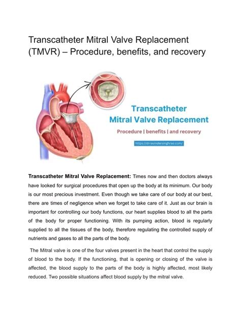 Ppt Transcatheter Mitral Valve Replacement Tmvr Powerpoint