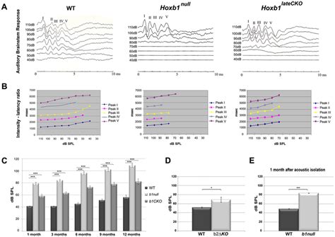 Elevated Thresholds Of Auditory Brainstem Responses ABR In Hoxb1 And