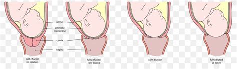 Cervix Pregnancy Dilated