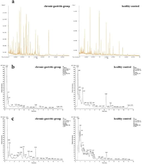 [PDF] The Abnormal Metabolites in Tongue Coating of Chronic Gastritis ...