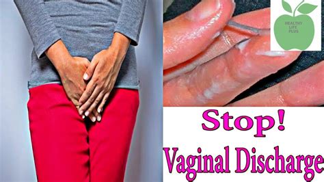 Causes Of Vaginal Discharge And Vaginal Itching Vulva And Vaginal Irritation Youtube