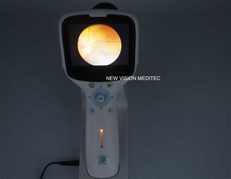 Portable Non Mydriatic Fundus Camera Hfc New Vision China