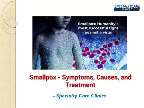 PPT - Smallpox - Symptoms, Causes, and Treatment PowerPoint ...