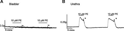 Effect Of Pe On Dsm And Usm Contractions A Representative Contractile