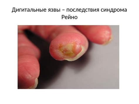 Системные заболевания соединительной ткани у детей - презентация онлайн
