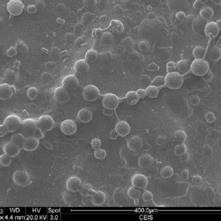 7.5 Electron Microscope image of calcium carbonate crystals induced by ...