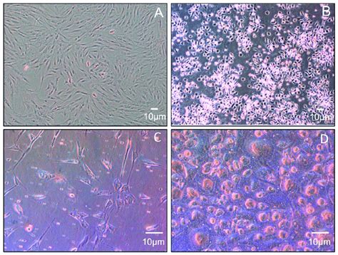 Representative Micrographs Phase Contrast Of Cultures At Different Download Scientific