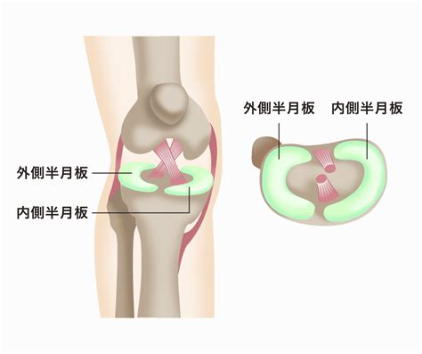 内側半月板 Mri 978140 内側半月板 Mri Gambarsaewyh