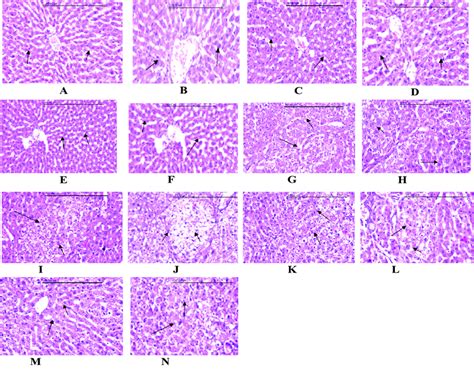 Photomicrographs Of Liver Specimens Stained With Hematoxylin And Eosin