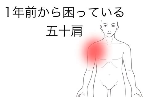 1年前から困っている五十肩 しらお鍼灸院