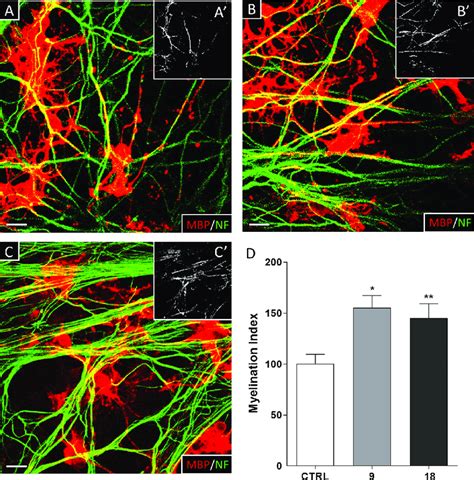 Effect Of Compounds 9 And 18 On Myelin Deposition In OPC DRG