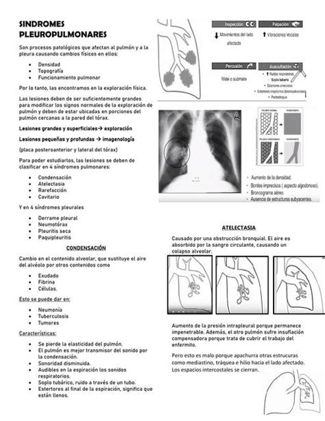 Sindromes Pleuropulmonares Patu Mg Udocz