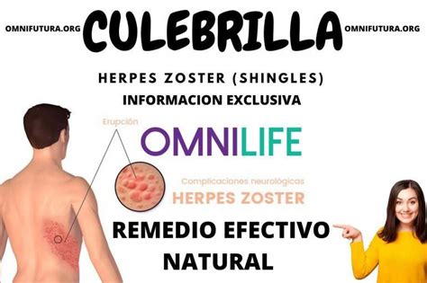 Omnilife Para La Culebrilla Herpes Zoster Remedio Natural