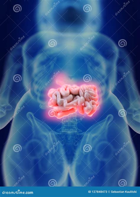 An Inflamed Intestine Stock Illustration Illustration Of Health