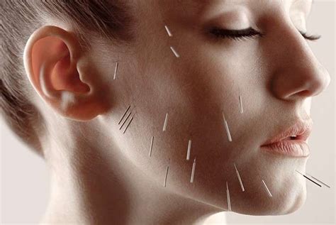 Facial Acupuncture The Point Acupuncture And Chinese Medicine In Denver