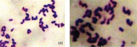 Gram stain of Corynebacterium pseudotuberculosis from caseous ...