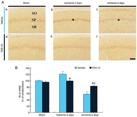 Immunohistochemistry For Hne In The Hippocampal Ca Field Following