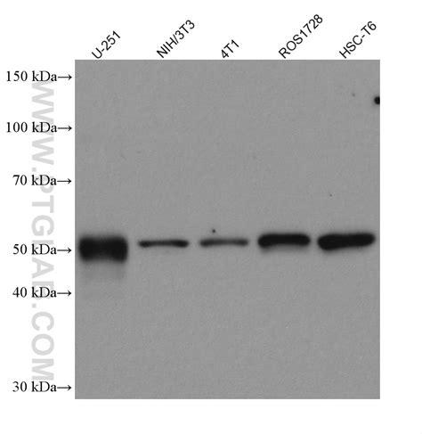 Vimentin Antibody 80232 1 Rr Proteintech 武汉三鹰生物技术有限公司