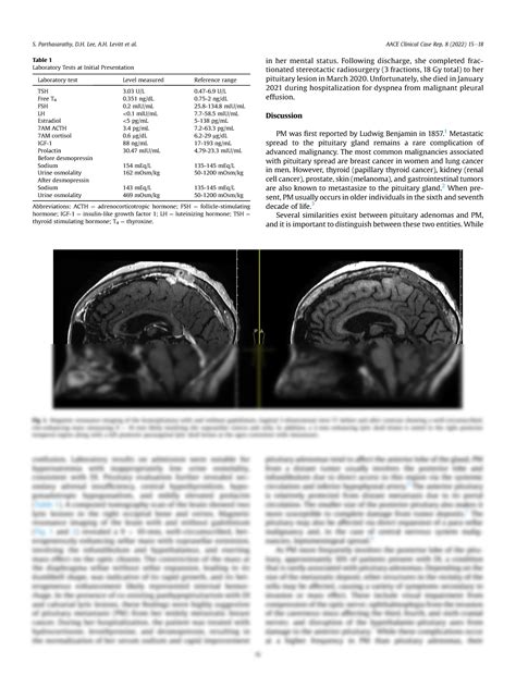 SOLUTION Pituitary Metastasis Presenting With Central Diabetes 2022