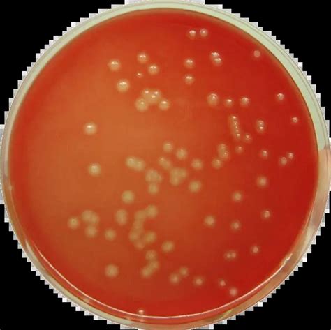 Streptococcus Agalactiae Gbs Properties Pathogenesis Lab Diagnosis