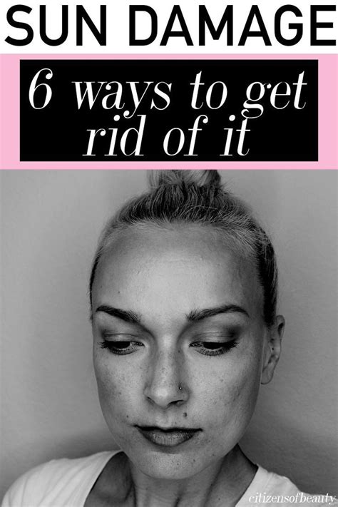 6 ways to prevent and get rid of brown spots citizens of beauty – Artofit