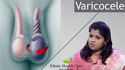 Varicocele उपचार Varicocele Natural Permanent Cure Siddha