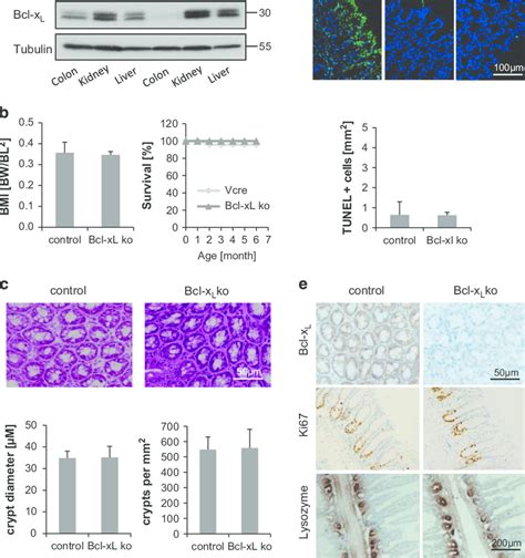 Basal Characterization Of Intestine Specific Bcl X L Knockout Mice A