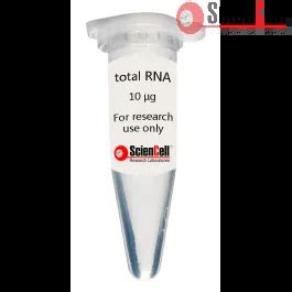 Human Pulmonary Artery Smooth Muscle Cell Total Rna Hpasmc Trna