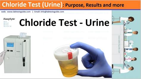 Chloride Urine Test Purpose Result And More Lab Tests Guide