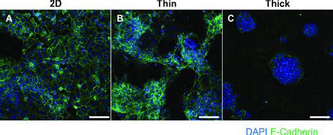 Immunofluorescent Staining Of E Cadherin And Dapi To Visualize