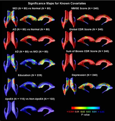 Figure 4 From Mapping Correlations Between Ventricular Expansion And