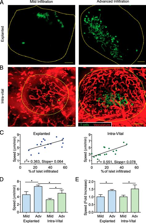 T Cell Motility Increases With Progression Of Islet Infiltration A