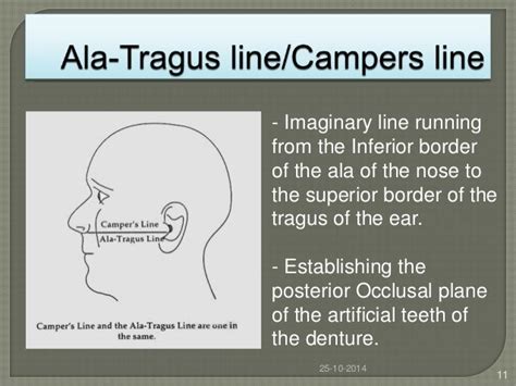 Facial Landmarks And Its Role In Prosthodontics