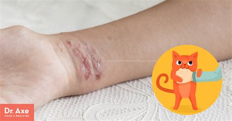 How To Heal Cat Scratches Warselection