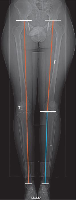 knee bone anatomy x ray