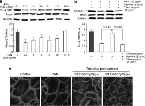 Triptolide Protects Podocytes From Puromycin Aminonucleoside Induced