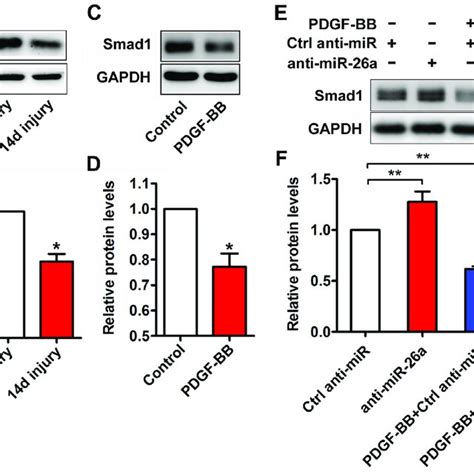 Mir 26a Is Implicated In Pdgf Bb Induced Proliferation And Migration In