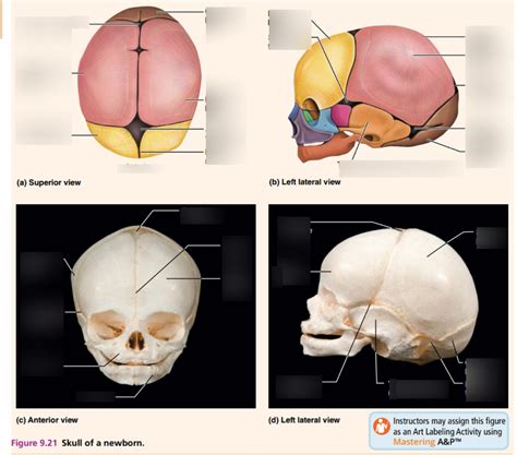 Skull Of Newborn Diagram Quizlet