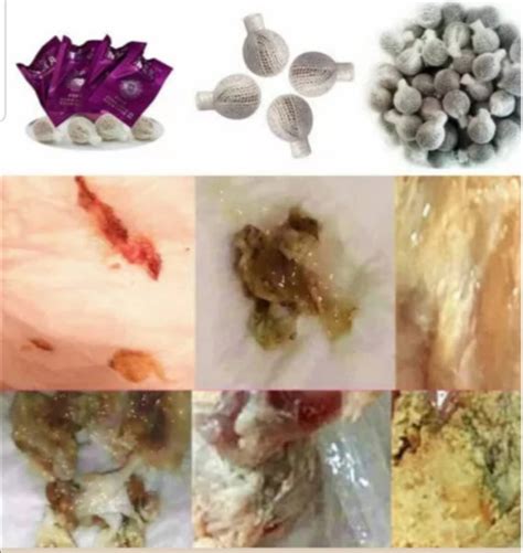 One Yoni Pearl Natural Herbal Womb Yoni Vaginal Cleansing Etsy