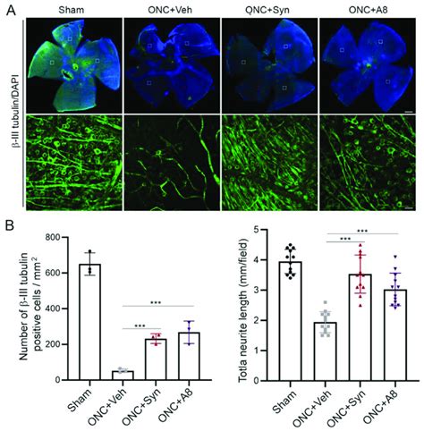 Onc Induced Rgc Loss Was Alleviated By Synaptamide Or A Treatment