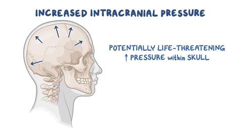 Increased Intracranial Pressure Icp Nursing Osmosis Video Library