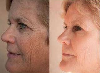 Toning The Face And Neck With Acupressure And Facelift Workouts: Yoga ...