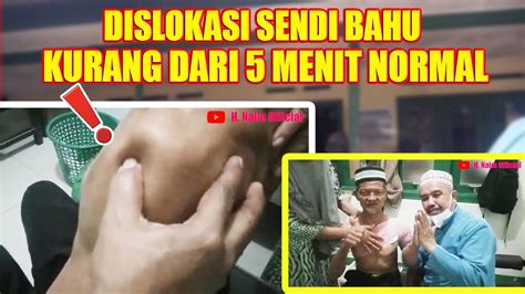 Dislokasi Sendi Bahu Kurang Dari Menit Normal Youtube