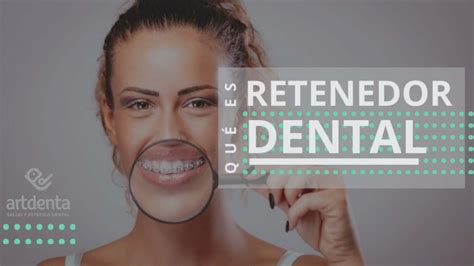 Retenedores Dentales Fijos Removibles Precios Clínica Dental en