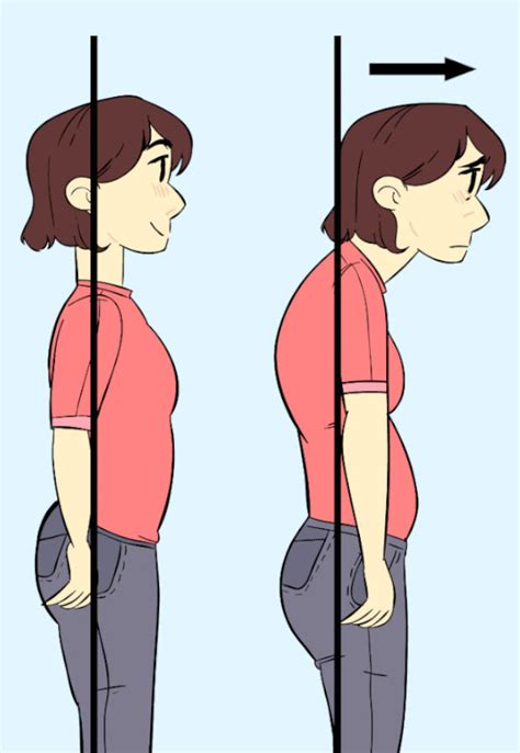 Forward Head Posture The Best 1 Ways To Fix It