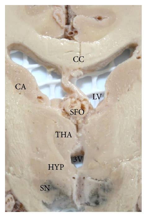 Frontal Section Photographs A B At Monroe Foramen And Sfo Level Download Scientific