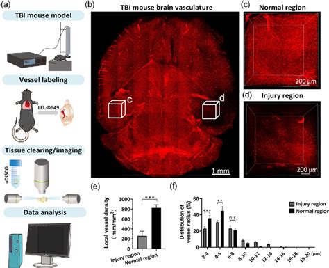 D Visualization And Analysis Of Changes Of Cerebrovascular Structures